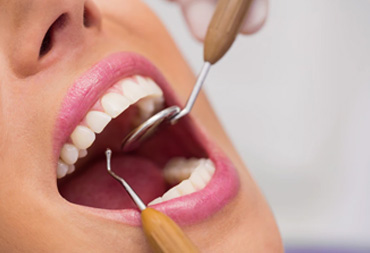 General Dentistry | Royal Smiles