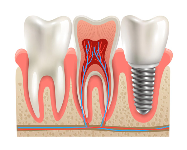 Dental Hospital Antalya